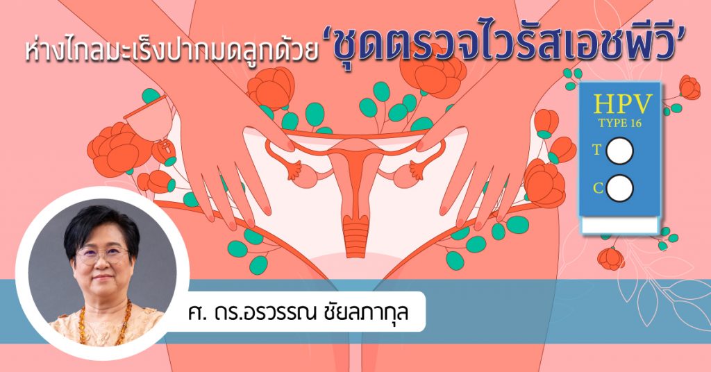 ชุดตรวจไวรัสเอชพีวี เซฟชีวิตหญิงไทย ห่างไกลมะเร็งปากมดลูก